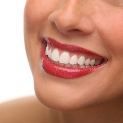 white-smile